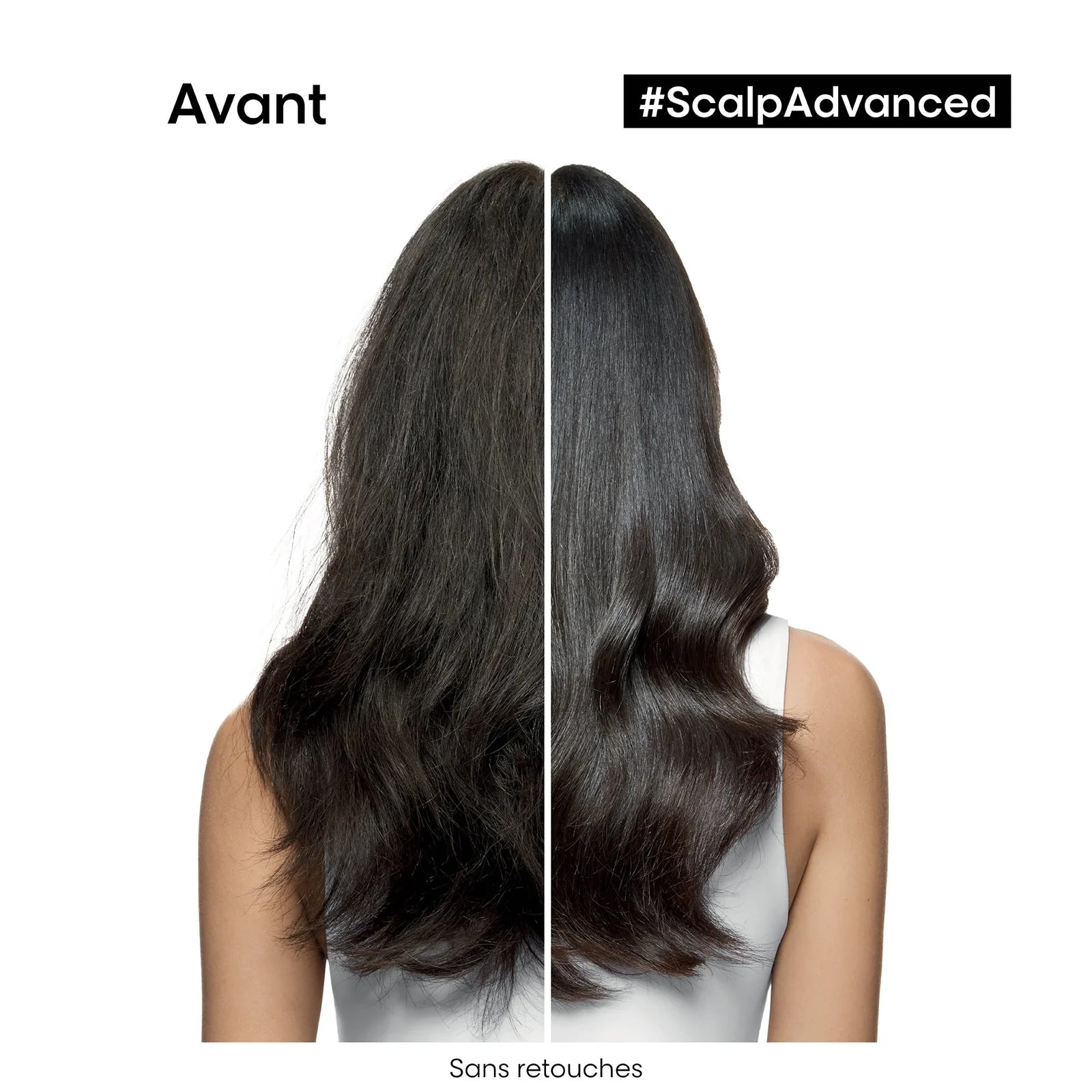 SHAMPOOING SCALP ADVANCED L'ORÉAL 500ML